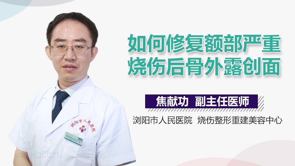 如何修复额部严重烧伤后骨外露创面