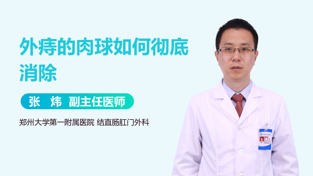 外痔的肉球如何彻底消除
