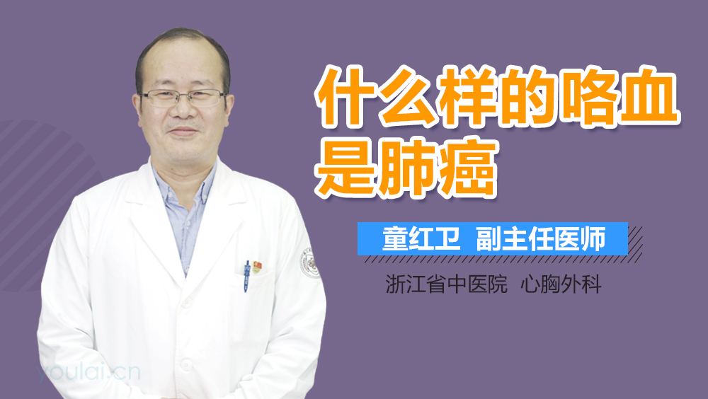 什么样的咯血是肺癌