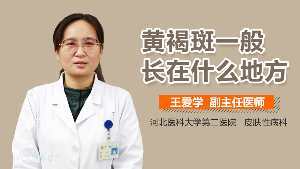 黄褐斑一般长在什么地方