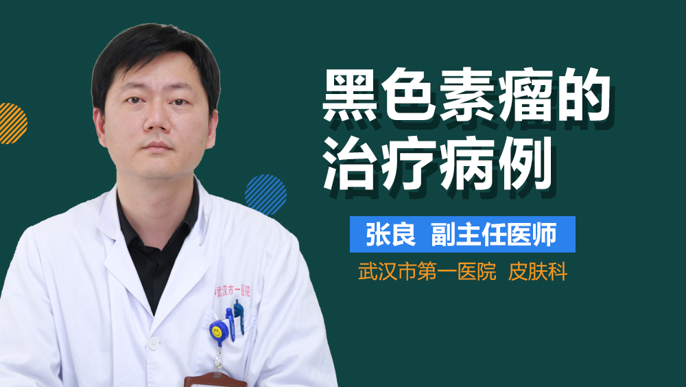 黑色素瘤的治疗病例