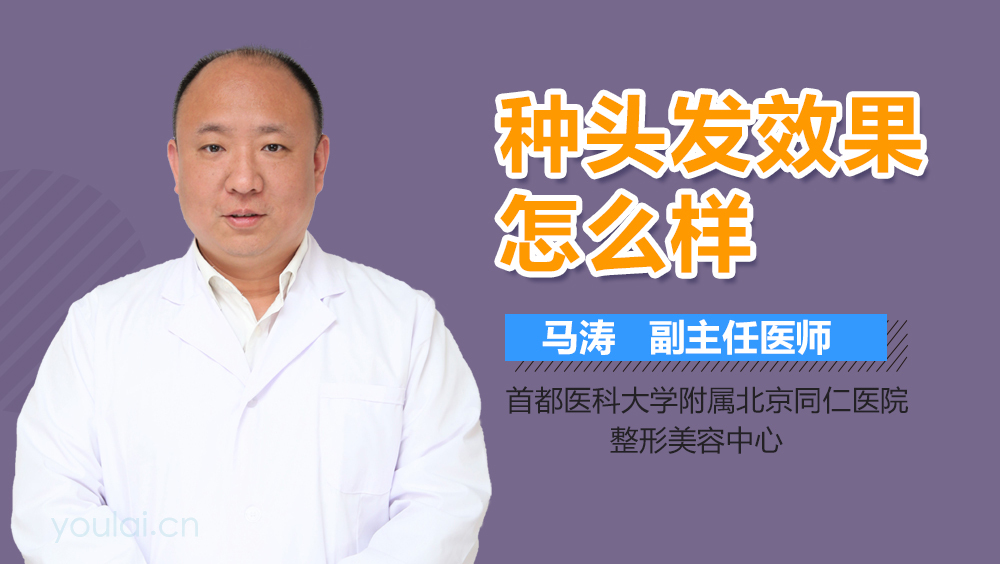 种头发效果怎么样