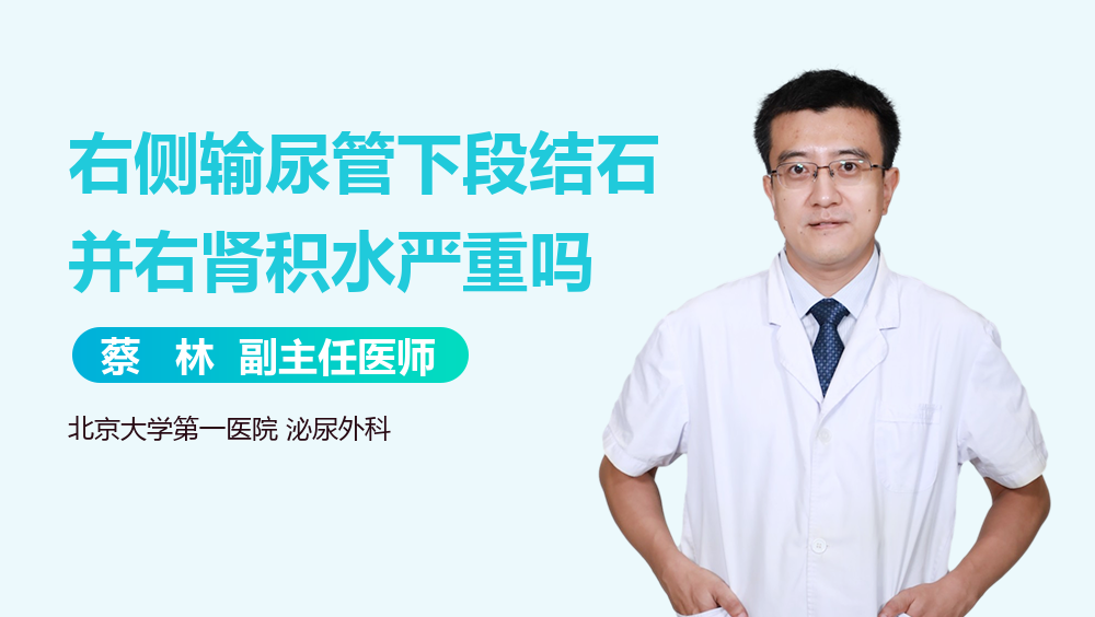 右侧输尿管下段结石并右肾积水严重吗
