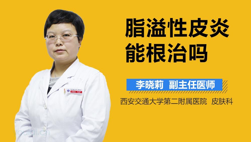 脂溢性皮炎能根治吗