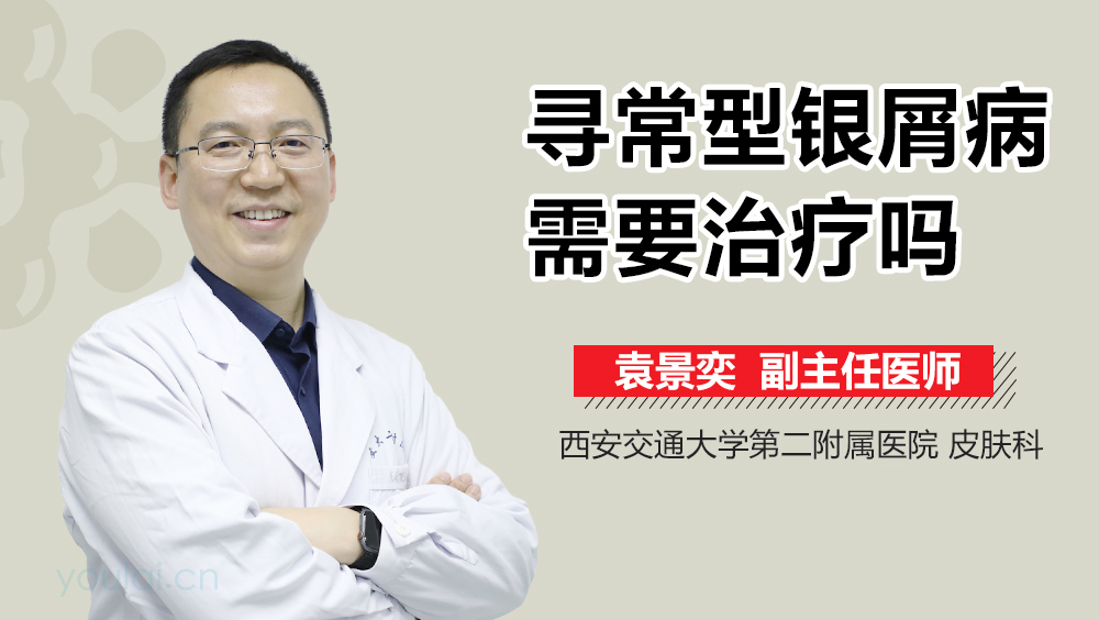 寻常型银屑病需要治疗吗