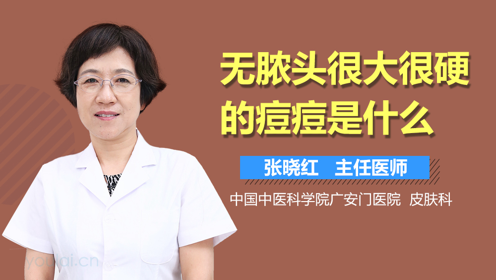 无脓头很大很硬的痘痘是什么