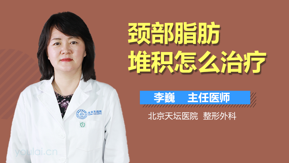 颈部脂肪堆积怎么治疗