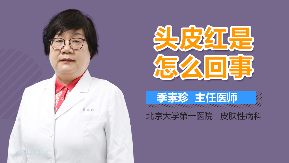 头皮红是怎么回事