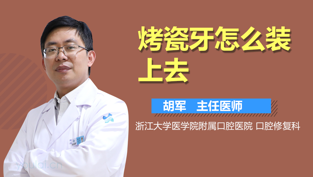 烤瓷牙怎么装上去