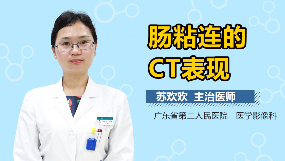 肠粘连的CT表现