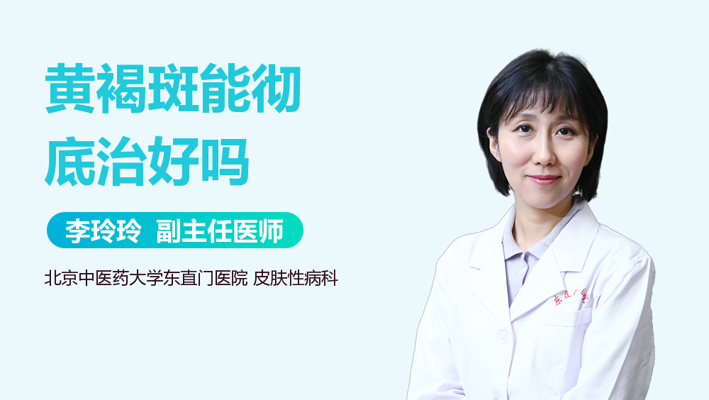 黄褐斑能彻底治好吗