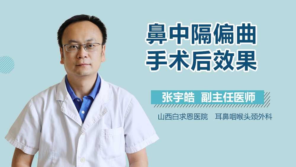 鼻中隔偏曲手术后效果