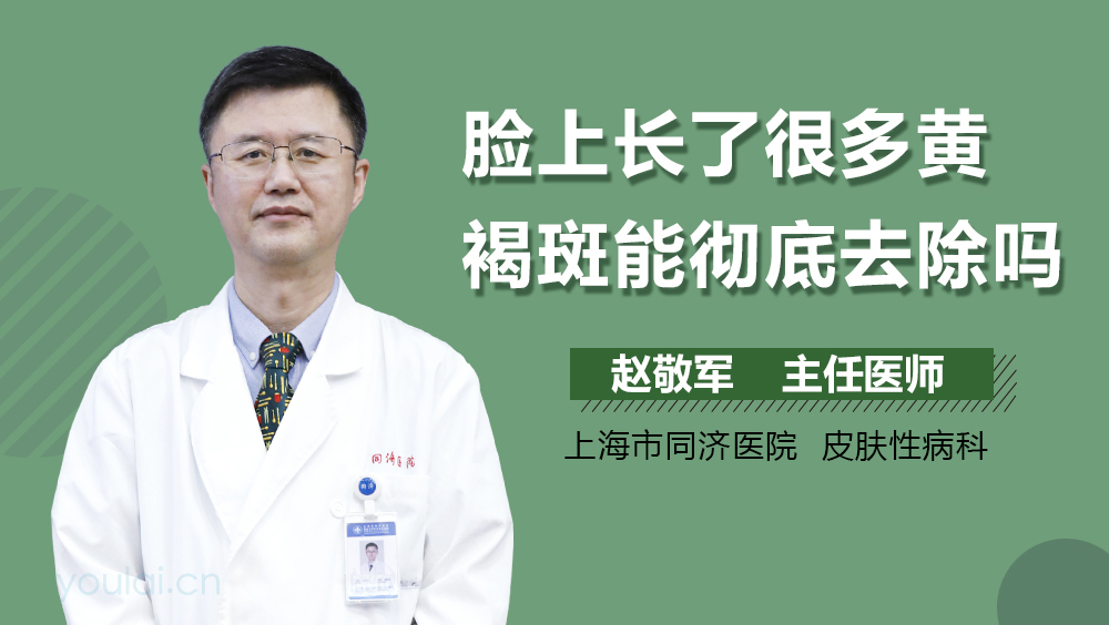 脸上长了很多黄褐斑能彻底去除吗