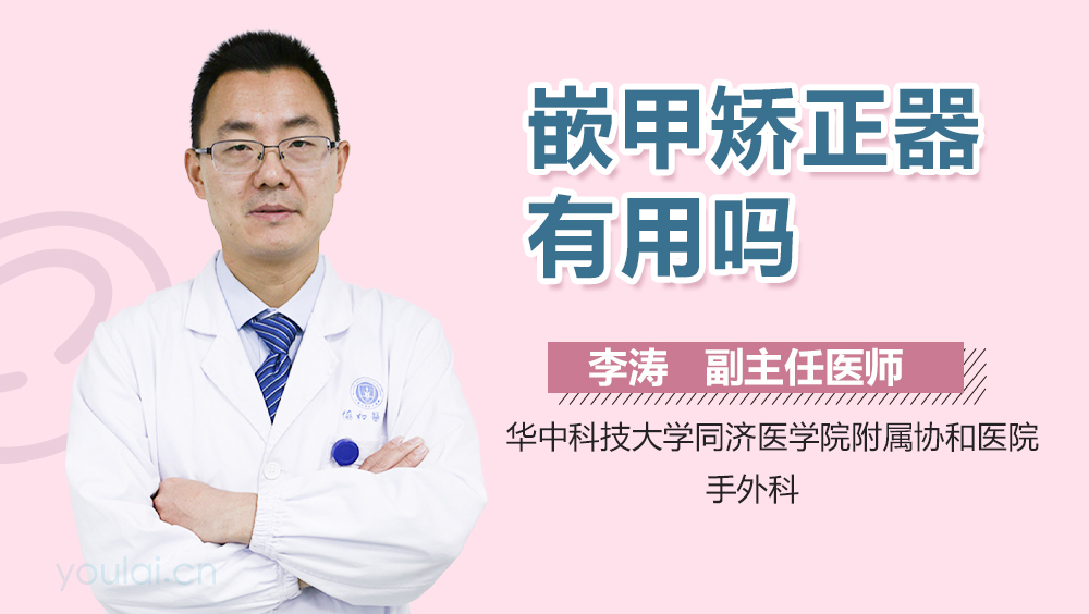 嵌甲矫正器有用吗