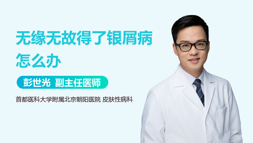 无缘无故得了银屑病怎么办