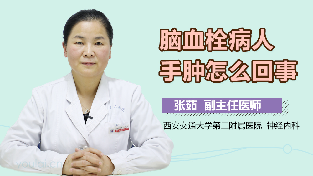 脑血栓病人手肿怎么回事