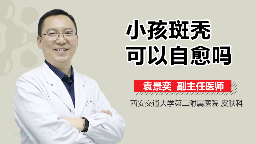 小孩斑秃可以自愈吗