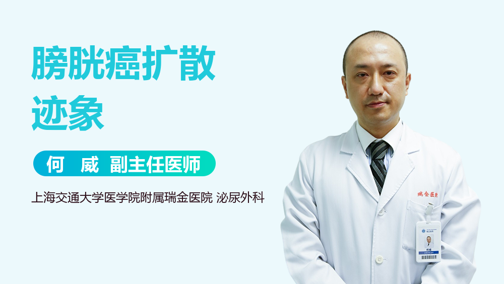 膀胱癌扩散迹象