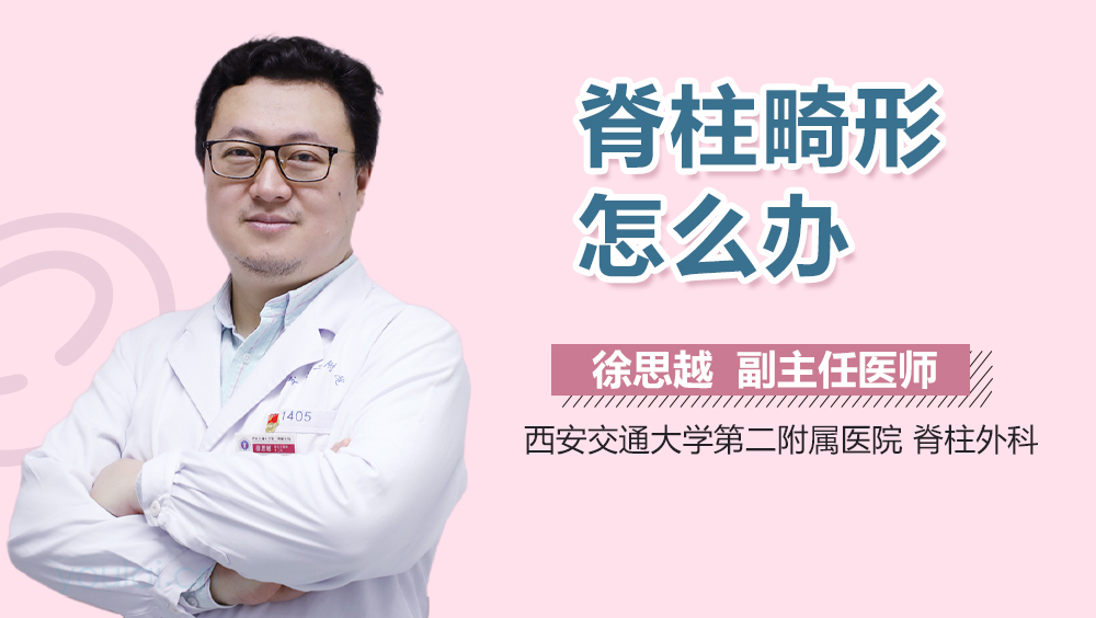 脊柱畸形怎么办