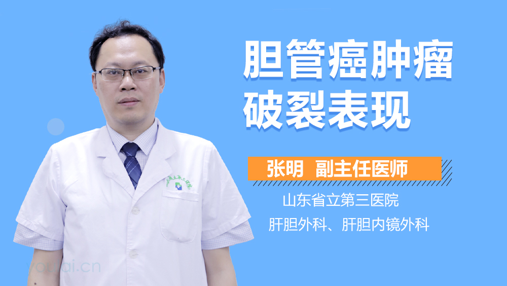 胆管癌肿瘤破裂表现