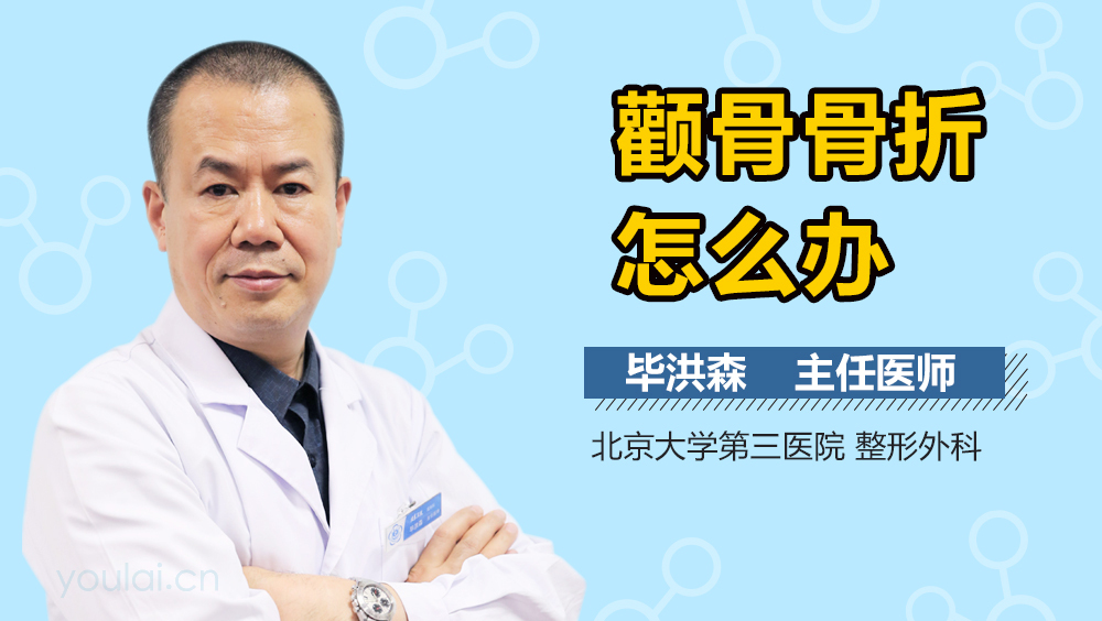 颧骨骨折怎么办