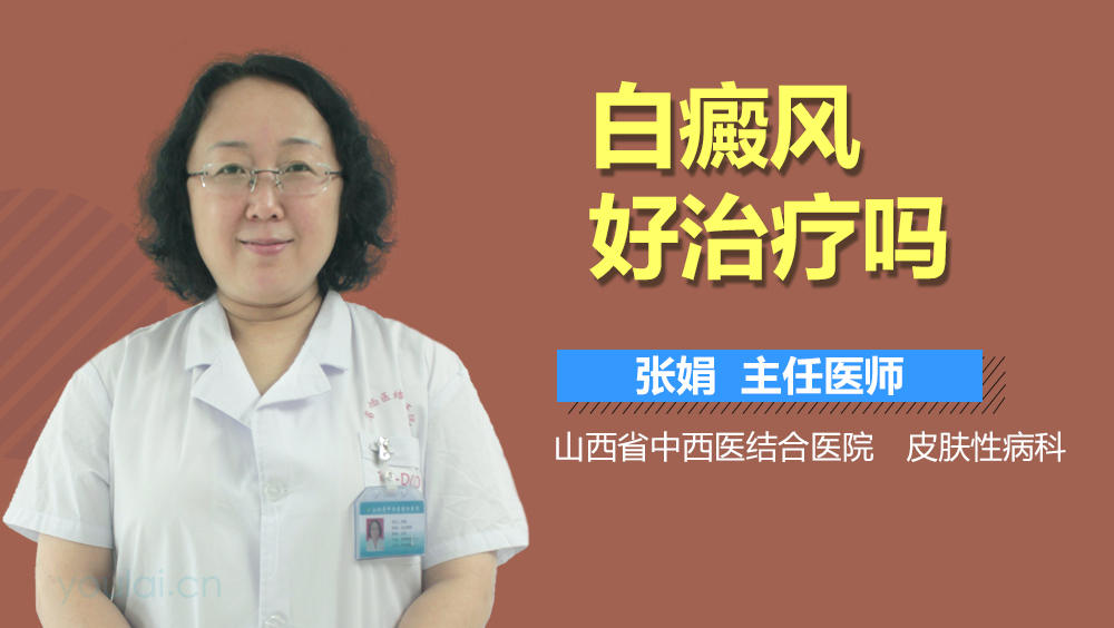 白癜风好治疗吗