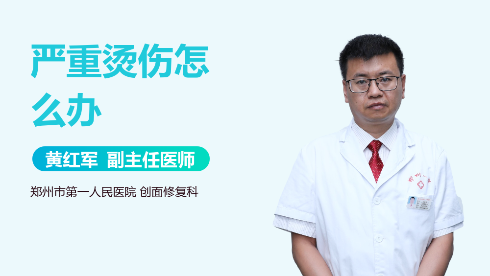 严重烫伤怎么办