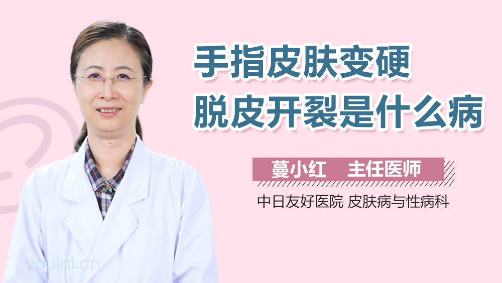 手指皮肤变硬脱皮开裂是什么病