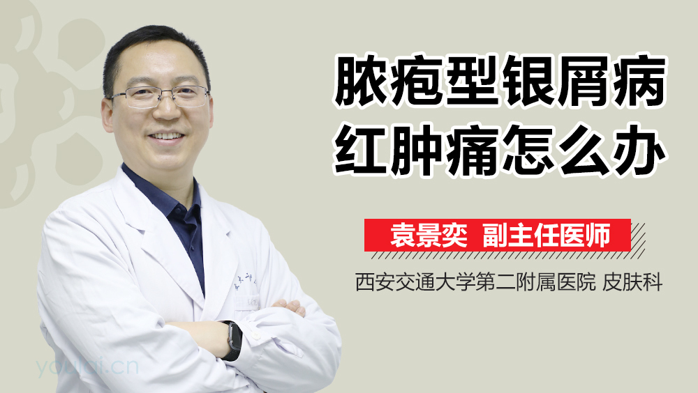 脓疱型银屑病红肿痛怎么办