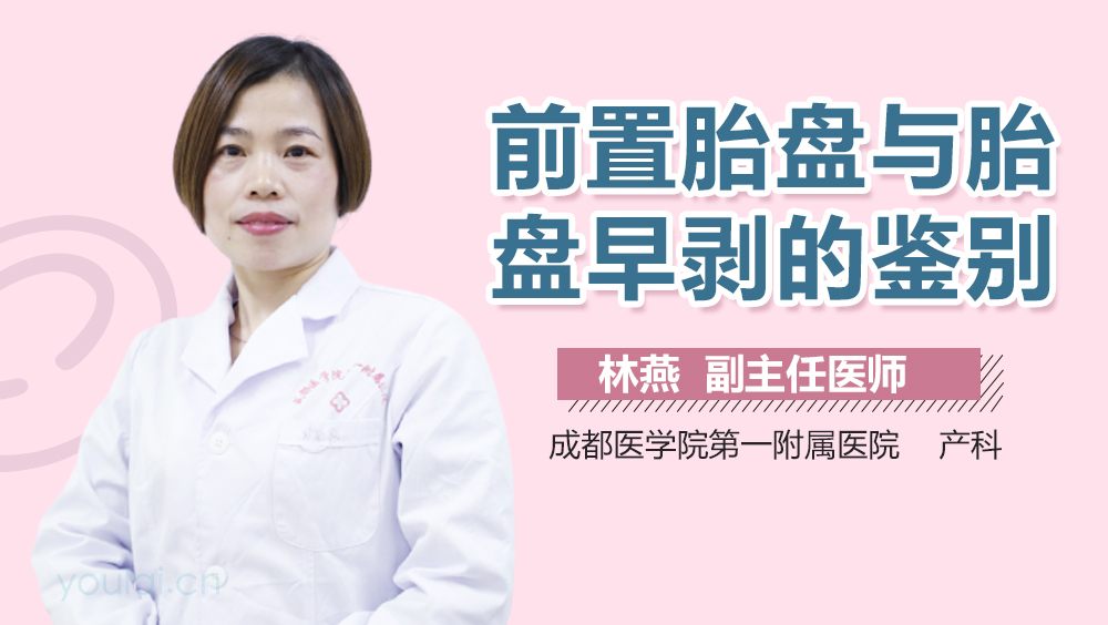 前置胎盘与胎盘早剥的鉴别