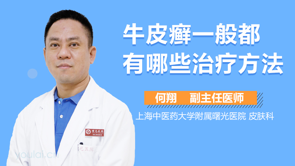 牛皮癣一般都有哪些治疗方法