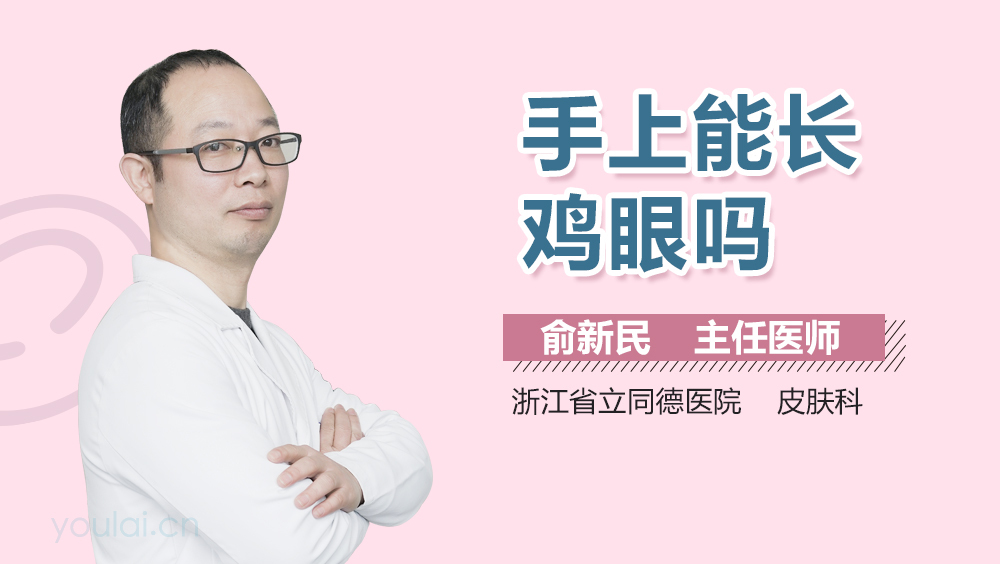 手上能长鸡眼吗