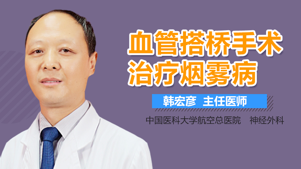 血管搭桥手术能治疗烟雾病吗