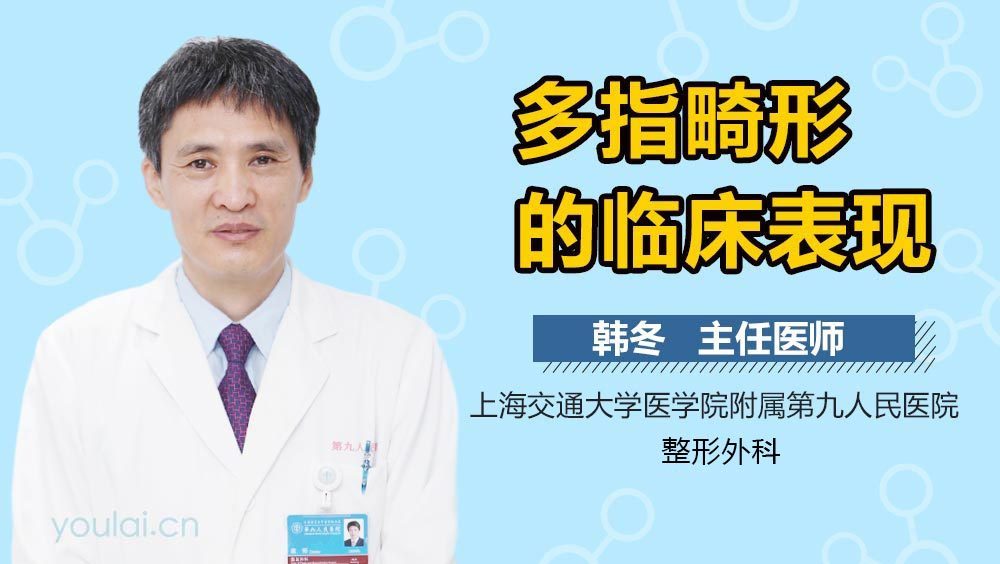 多指畸形的临床表现
