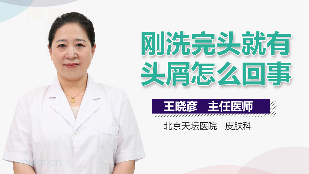 刚洗完头就有头屑怎么回事