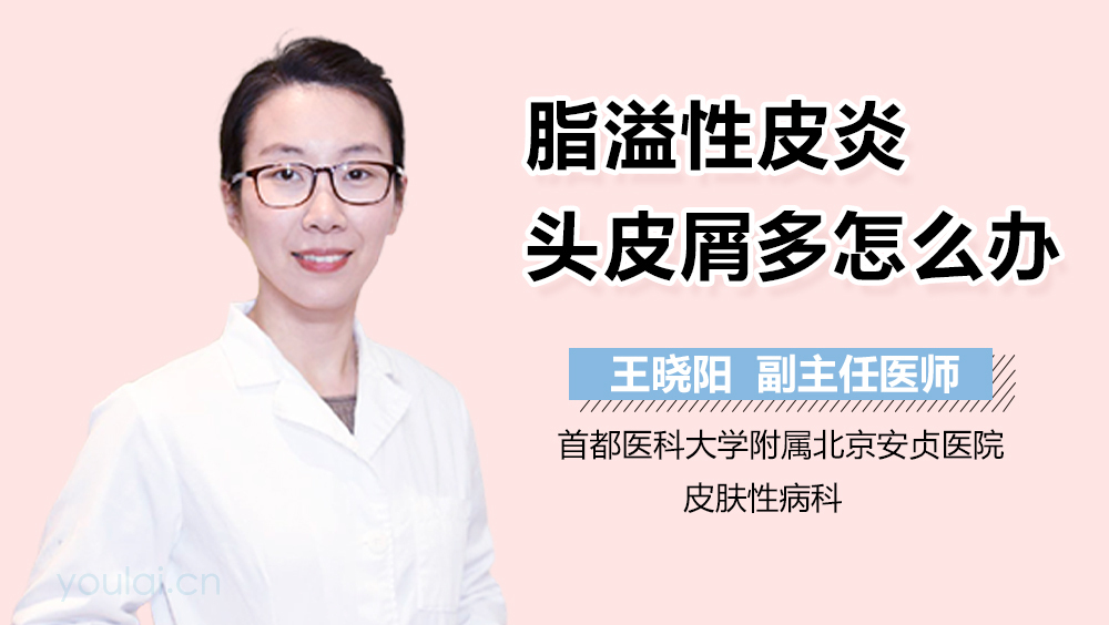 脂溢性皮炎头皮屑多怎么办