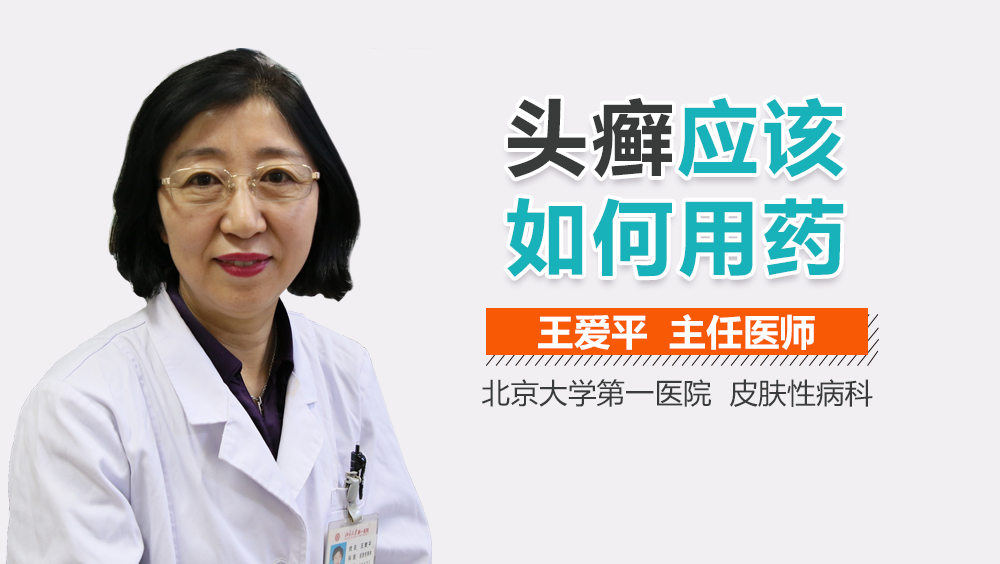 头癣应该如何用药