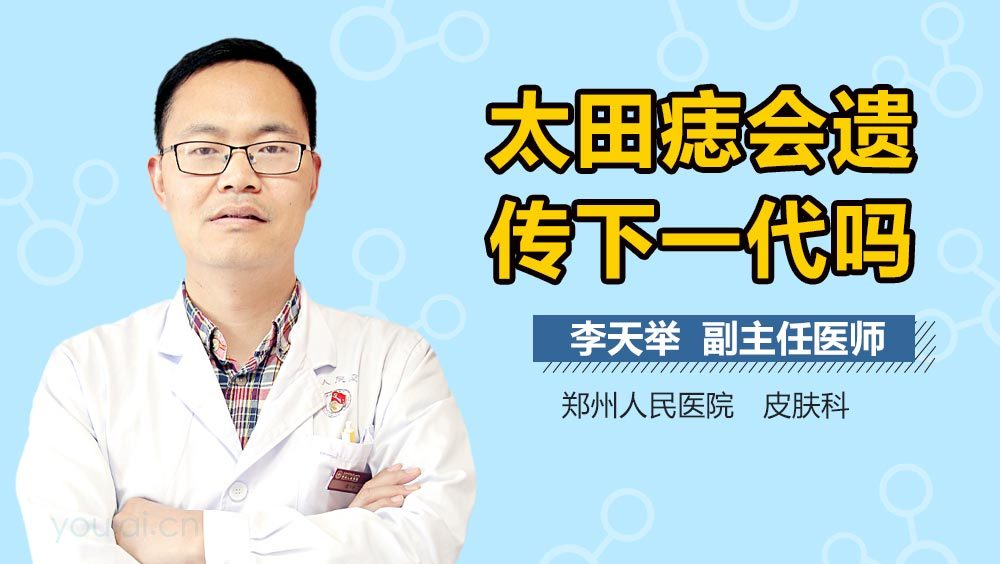 太田痣会遗传下一代吗