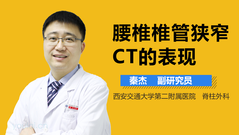 腰椎椎管狭窄CT的表现