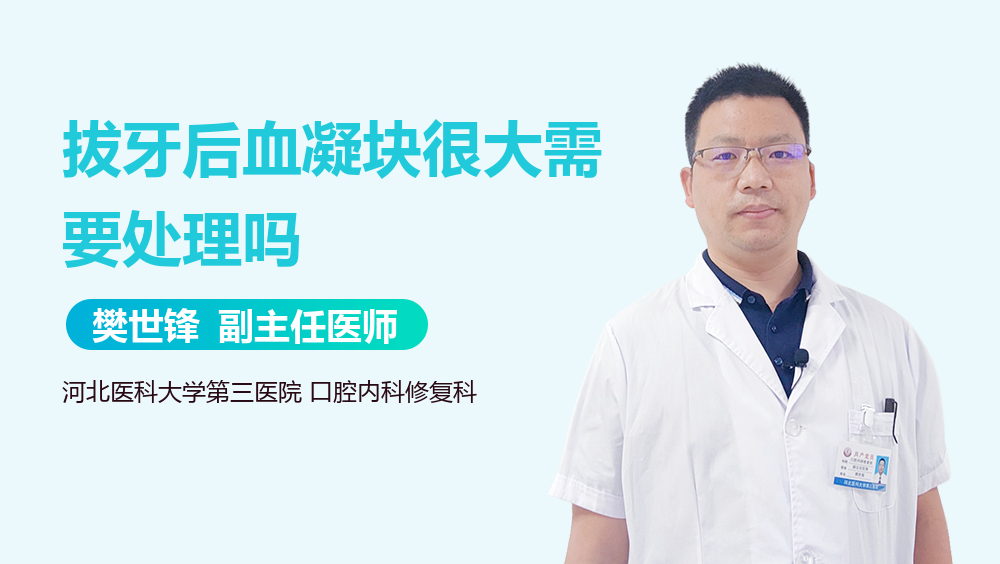 拔牙后血凝块很大需要处理吗