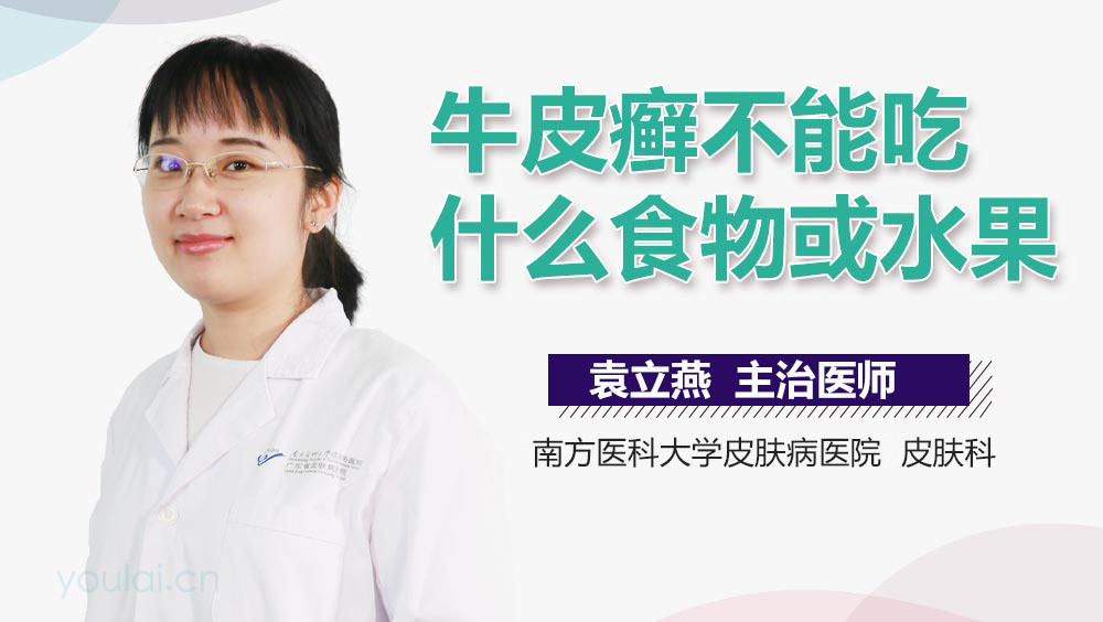牛皮癣不能吃什么食物或水果