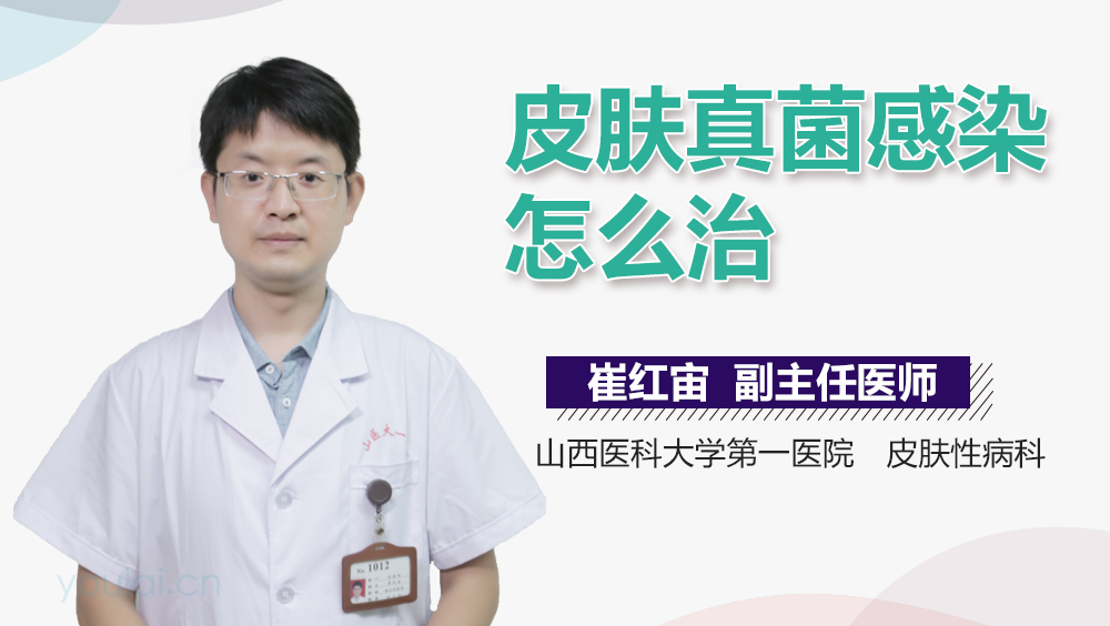 皮肤真菌感染怎么治