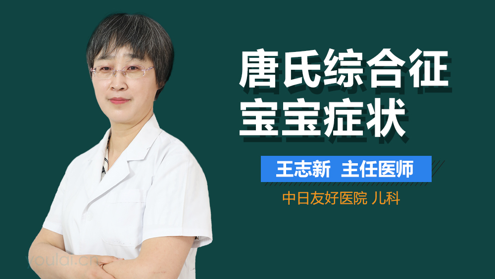 唐氏综合征宝宝症状