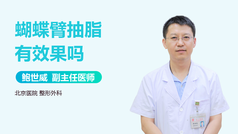 蝴蝶臂抽脂有效果吗