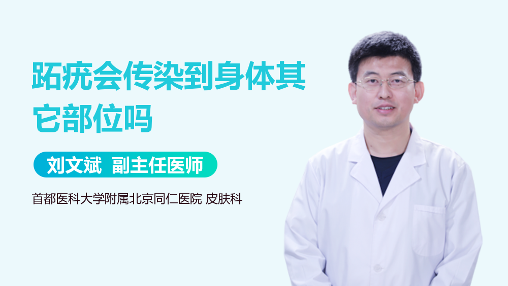 跖疣会传染到身体其它部位吗