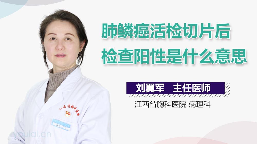 肺鳞癌活检切片后检查阳性是什么意思