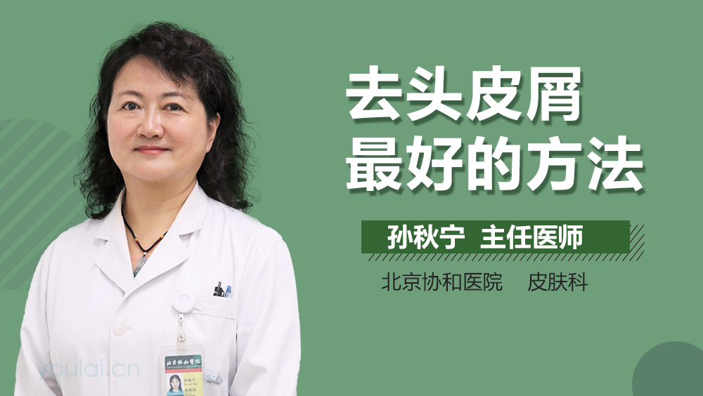 去头皮屑最好的方法