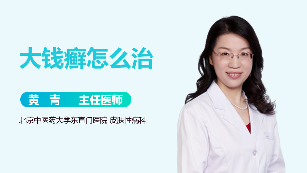 大钱癣怎么治