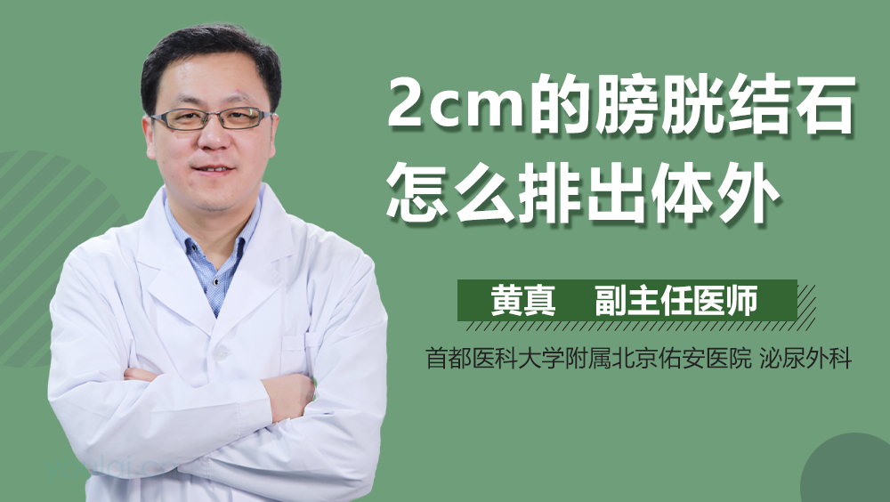2cm的膀胱结石怎么排出体外