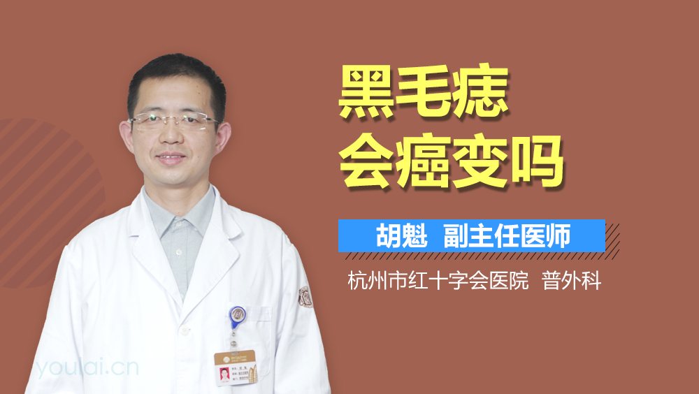 黑毛痣会癌变吗